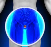 Enlarged Prostate (BPH) Treatment in Johnson City, TN