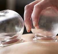 Cupping Therapy Massage in New Port Richey, FL