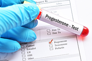 Progesterone Level Testing in Alpharetta, GA