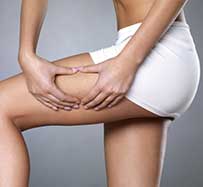 Extracorporeal Shock Wave Cellulite Treatment in Midland Park, NJ
